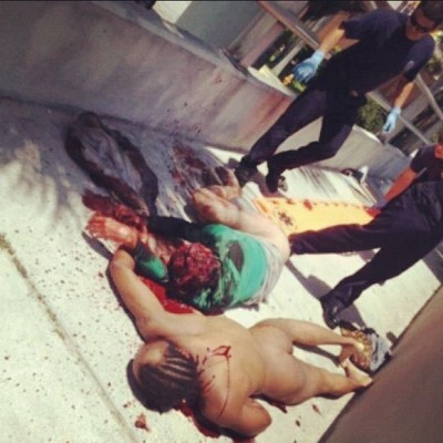 Des nouvelles de la victime du zombie de Miami